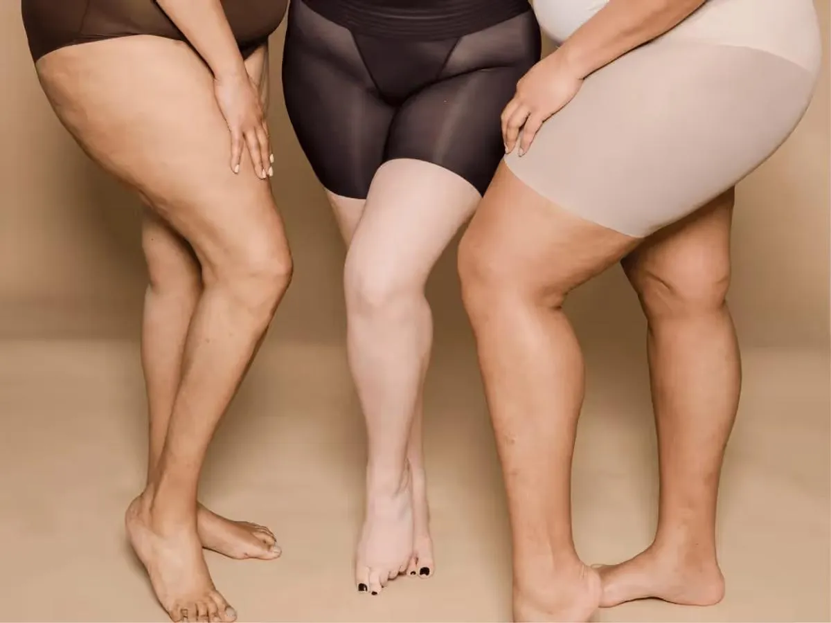Drei Frauen mit kräftigen Beinen, die Spaß haben trotz Lipödem